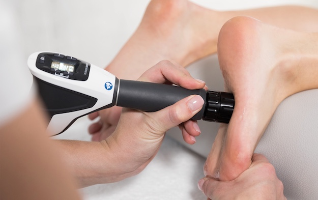 Shockwave Therapy for Plantar Fasciitis from Elevate Physiotherapy